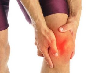 Bệnh nhân thoái hóa khớp gối nặng