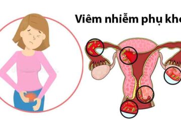 Bệnh phụ khoa ở nữ giới – Nguyên nhân, dấu hiệu nhận biết và cách phòng tránh