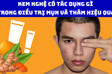 Kem nghệ có tác dụng gì trong điều trị mụn và thâm hiệu quả
