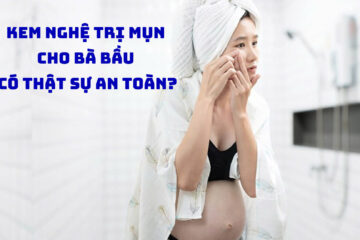 Kem nghệ trị mụn cho bà bầu có thật sự an toàn và hiệu quả